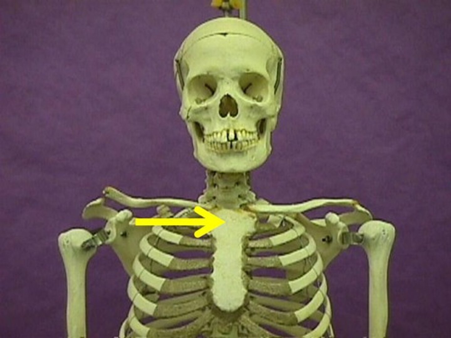 <p>Name the portion of the bone.</p>
