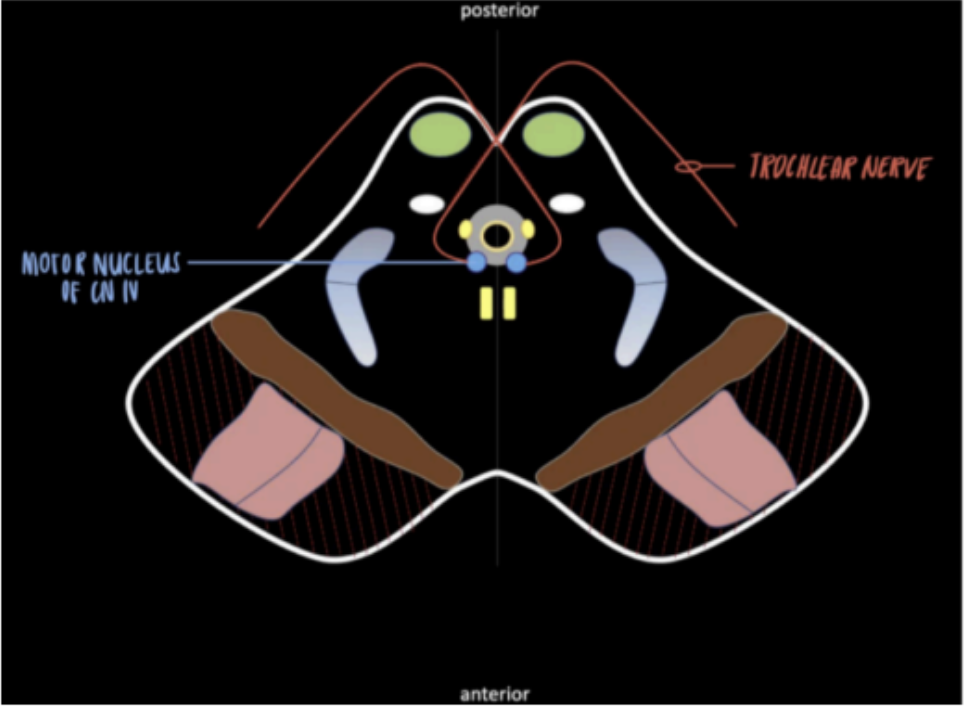 <ul><li><p>Trochlear Nerve (CN IV)</p></li><li><p>Motor of the Nucleus of CN IV</p></li></ul><p></p>