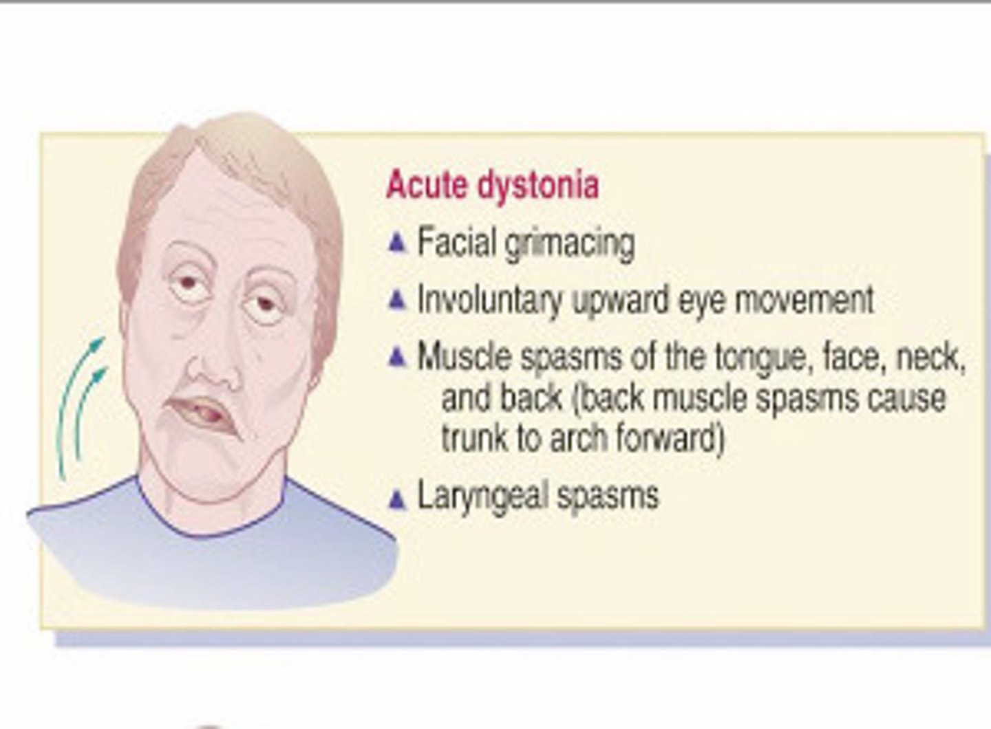 <p>Involuntary muscle contractions resulting in abnormal posturing or repetitive movements; associated w/ meds</p>