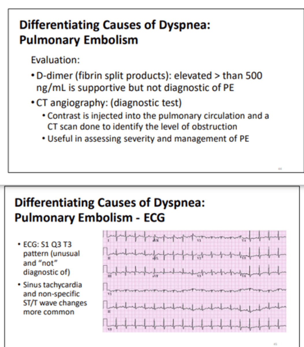 <p>1. Sinus tachycardia<br>2. Atrial fibrillation</p>