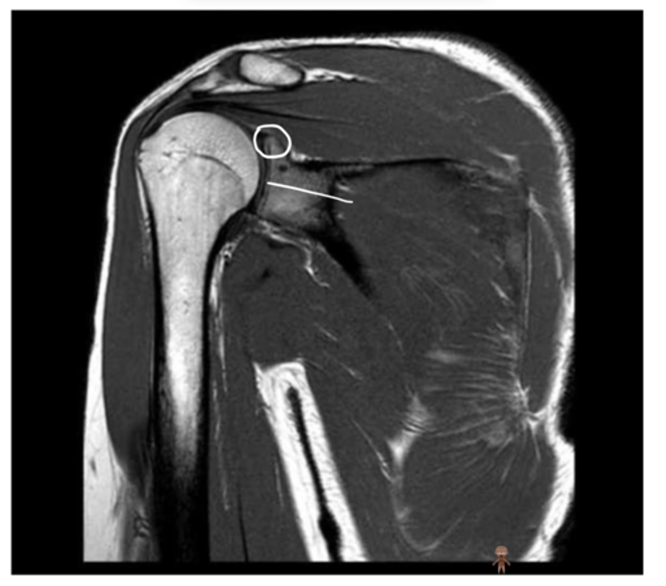 <p>What has been circled and what has been pointed to in this image?</p>