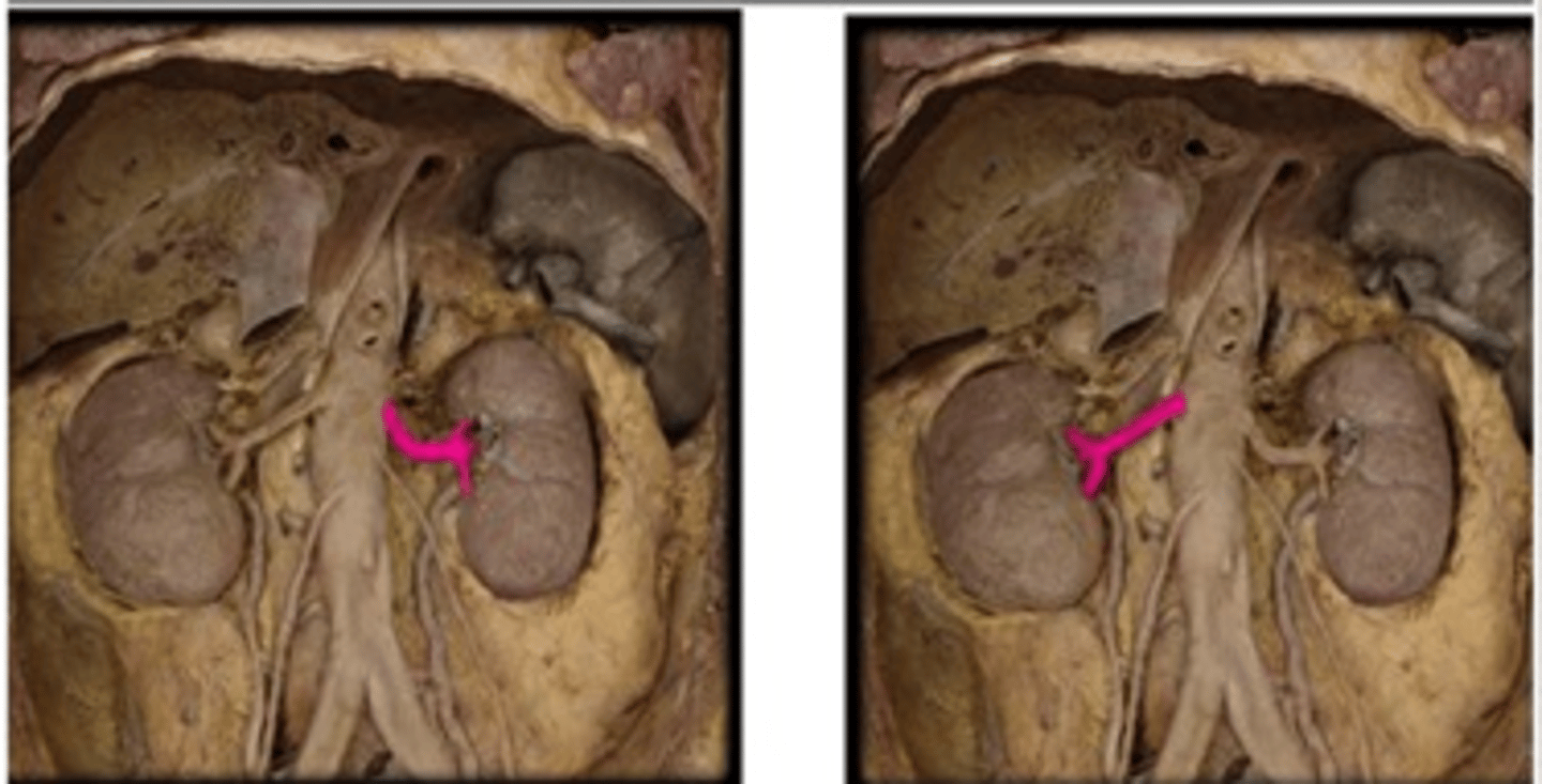 <p>below the kidney for left.</p>