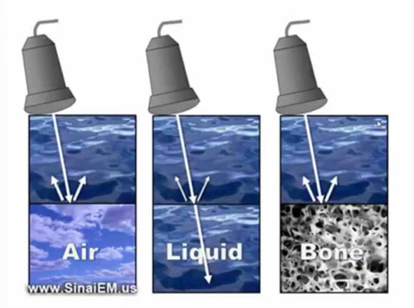 <p>What structures within the ultrasound probe convert sounds waves to an electric current? The computer in the ultrasound machine converts the electric current to an image.</p>