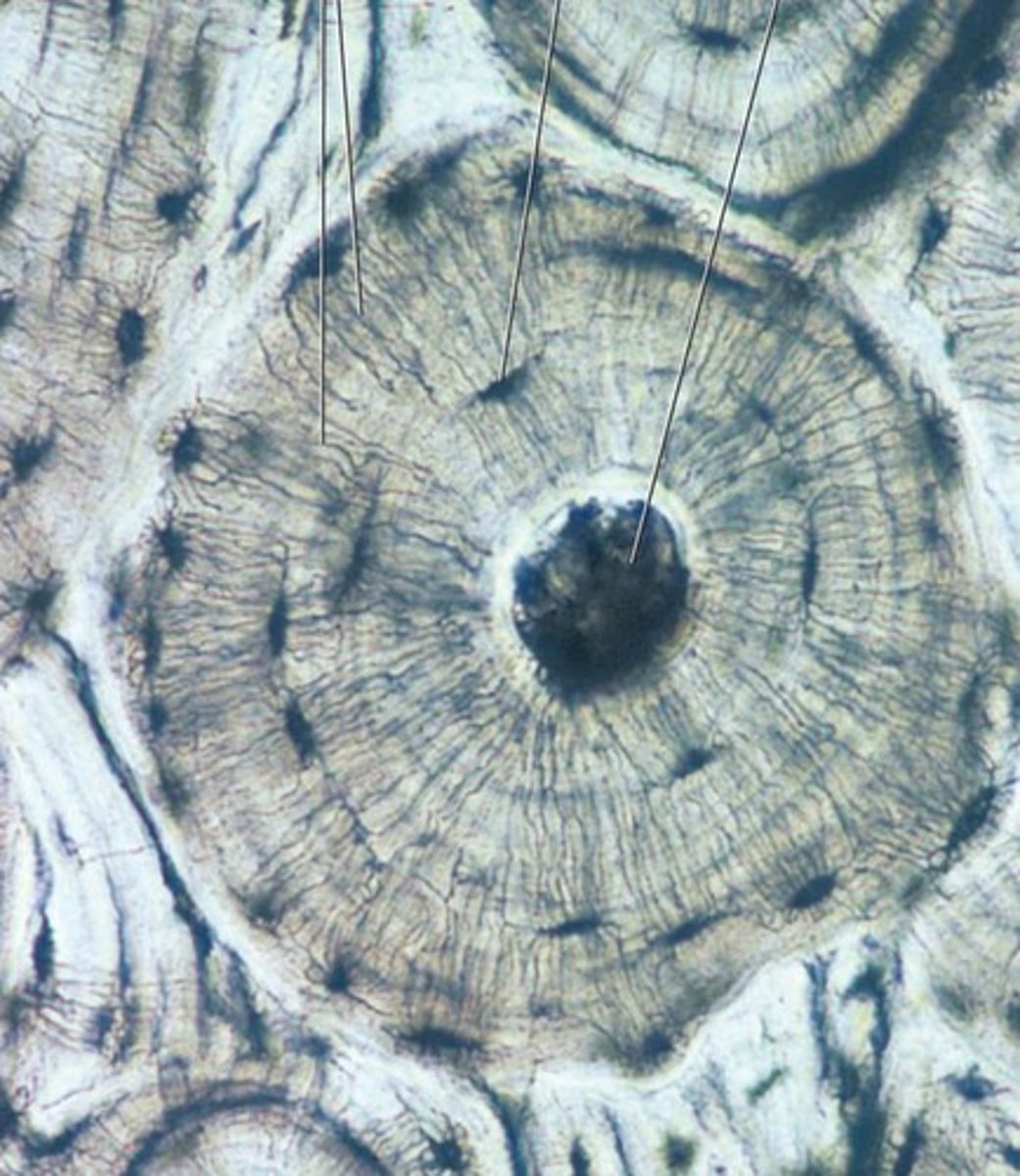 <p>osseous tissue, osteocytes in lacunae, hard matrix full of calcium, Most rigid connective tissue, Internally supports body structures, very active tissue, heals much more rapidly than cartilage</p>