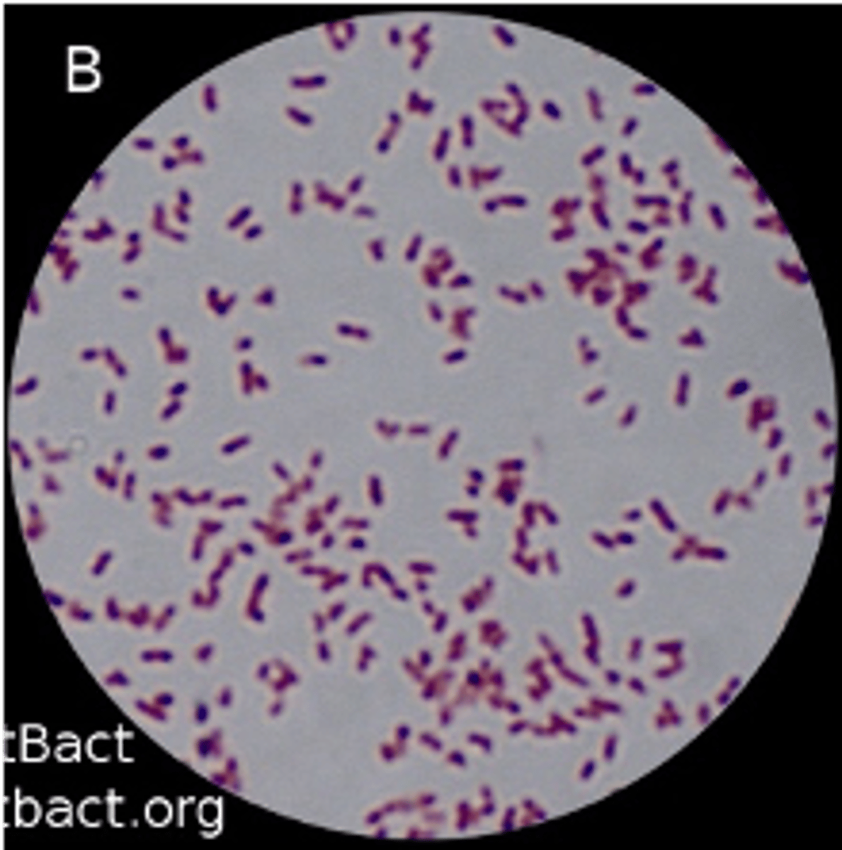 <p>this bacteria is associated with varying strains and types of diseases in different species but can primarily lead to respiratory infections in dogs, pigs, and turkeys</p>