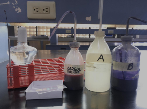 <p>What is the name of the reagent labeled B in this test?</p>