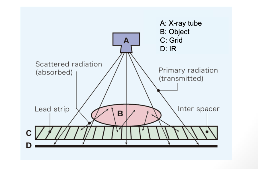 <p><strong>What does a Grid ABSORB in radiography?</strong></p>