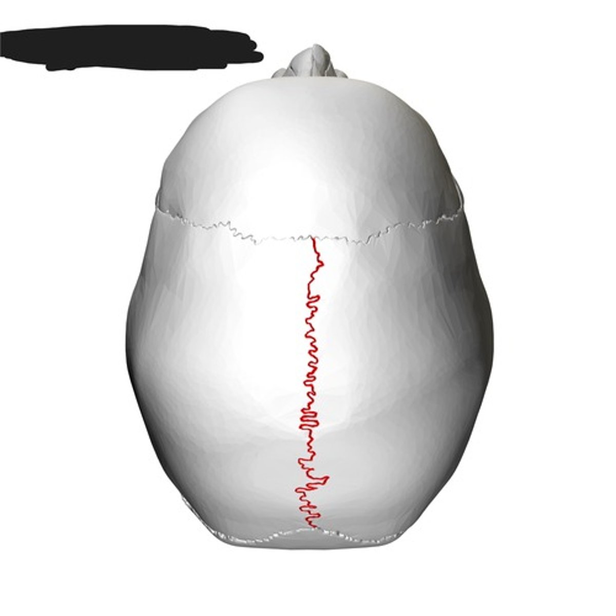 <p>Sagittal suture</p>