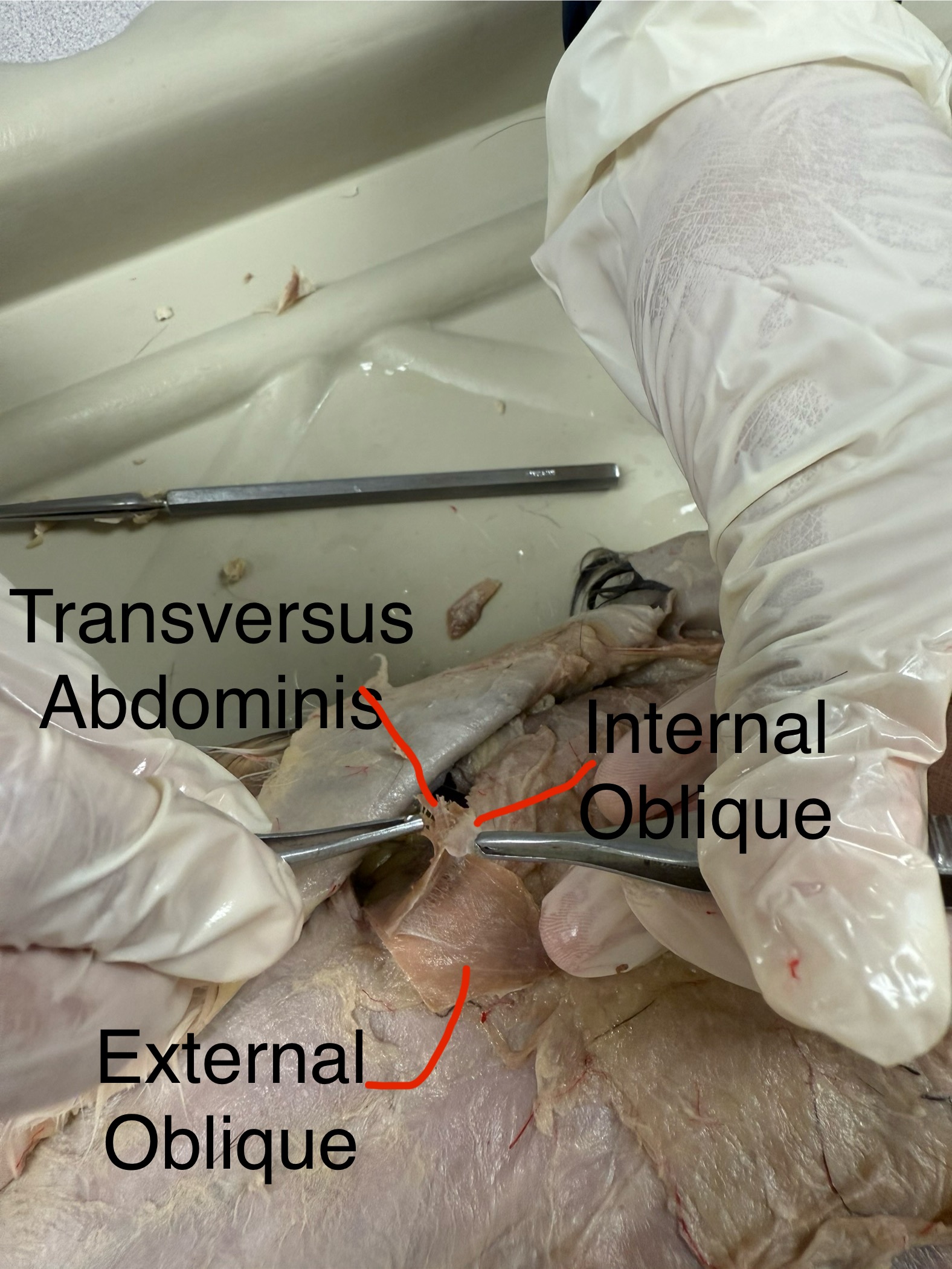 <p>External abdominal oblique action: constricts abdomen </p><p>Internal abdominal oblique action: compresses abdomen </p><p>Transverse abdominis action: constricts abdomen</p>