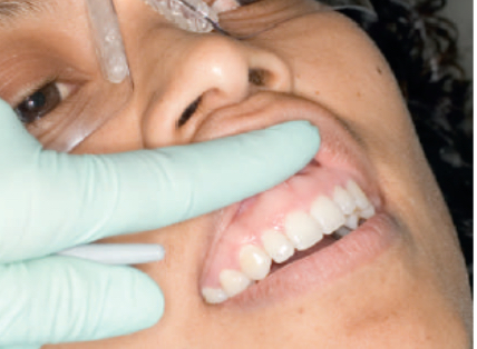 <p><strong>How do you retract the lip?</strong></p>