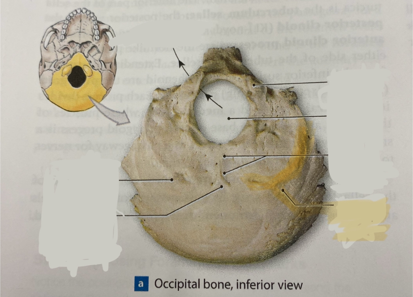 <p>what structure is this?</p>