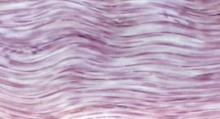 <p>a type of connective tissue characterized by closely packed parallel collagen fibers, providing tensile strength in one direction. It is commonly found in tendons and ligaments. </p>