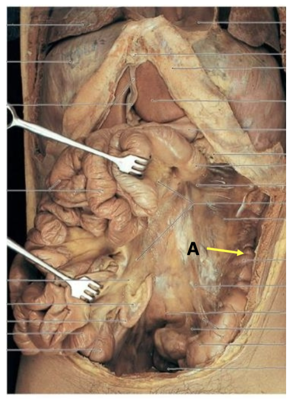 <p><span>What is the location of the postganglionic sympathetic neuron for this location?</span></p>