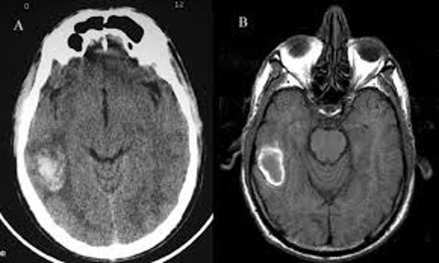 <p>Technology that uses X-Rays to create in depth measurements of brain structures.</p>