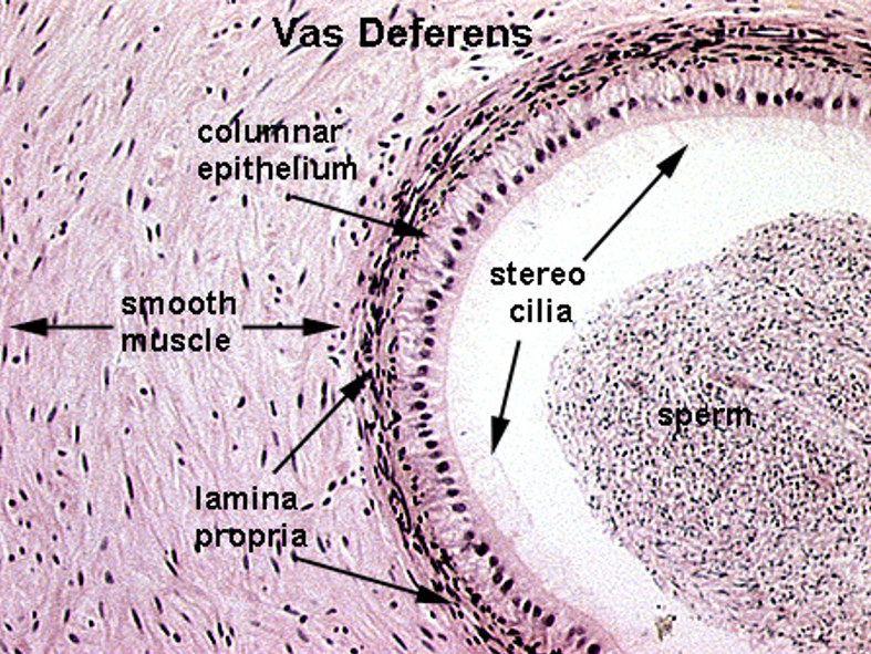 <p><strong>Vas deferens</strong></p><ul><li><p class=""><strong>Pseudostratified columnar epithelium</strong> with <strong>stereocilia</strong></p></li><li><p class=""><strong>Small, irregular lumen</strong> compared to thick wall</p></li><li><p class="">Surrounded by a <strong>very thick muscularis</strong> with <strong>three layers</strong>: inner longitudinal, middle circular, outer longitudinal</p></li><li><p class="">Often has a <strong>folded mucosa</strong></p></li></ul><p></p><p><em>Vas deferens stores sperm</em></p>
