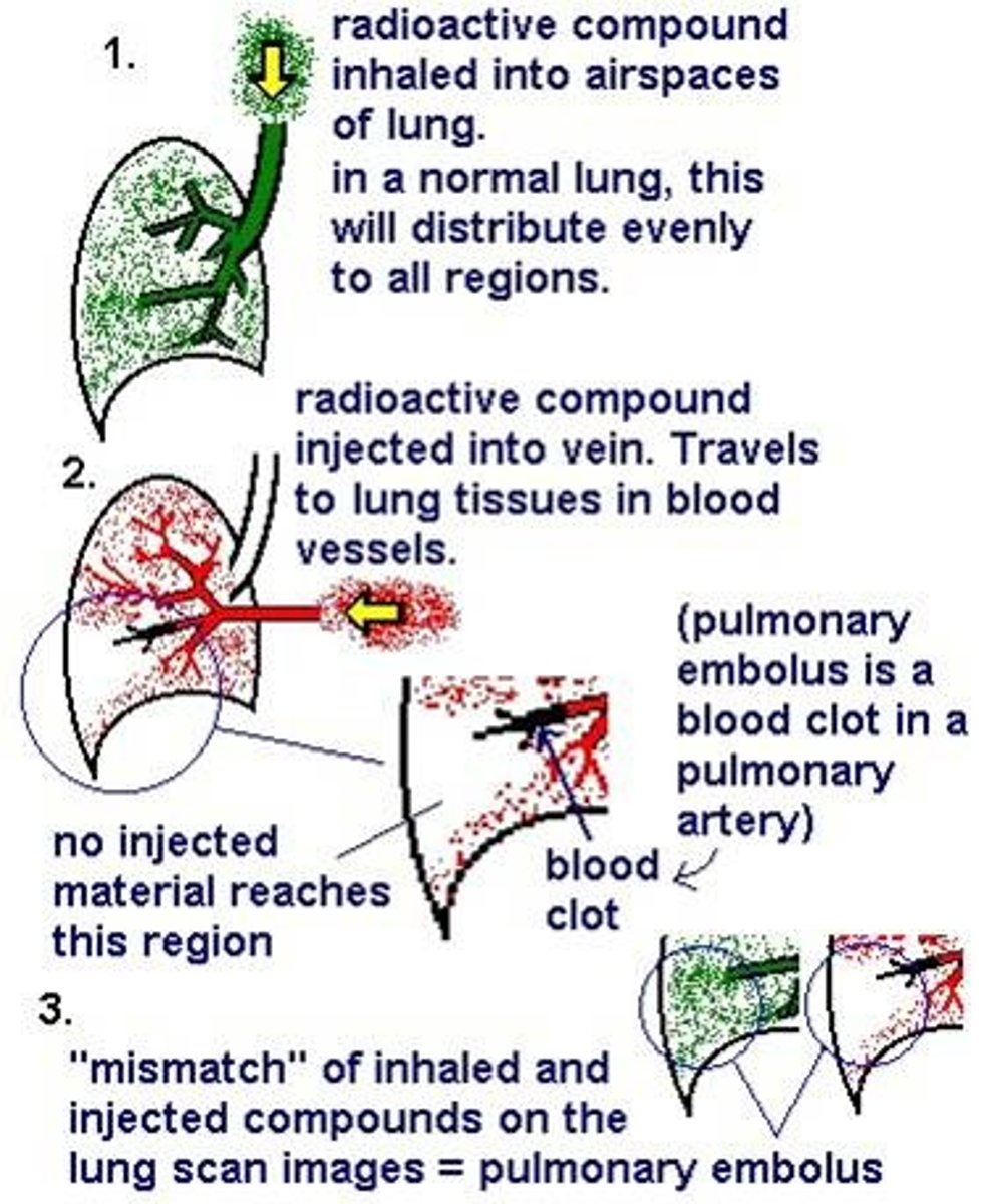 <p>when would you use this instead of CT with iv contrast</p>