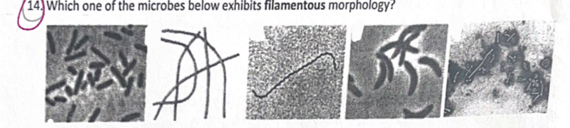 <p><span>Which one of the microbes below exhibits filamentous morphology?</span></p>