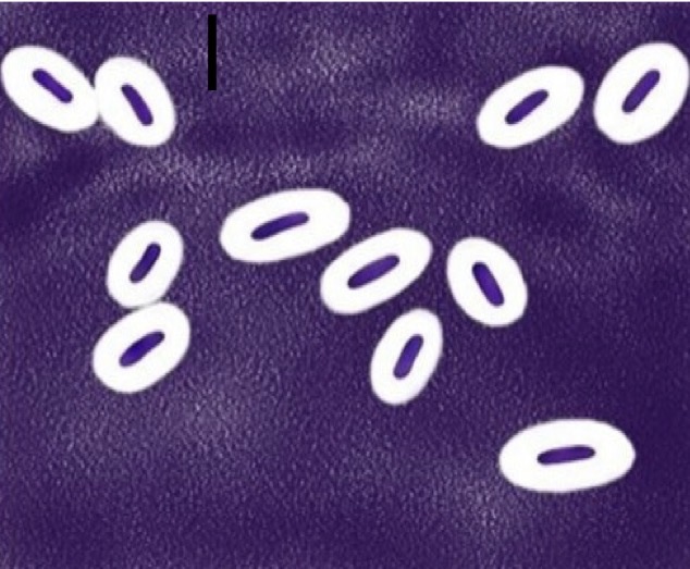 <p>A- identify this stain</p><p>B- Give example</p><p>C- Give other examples of stains</p>