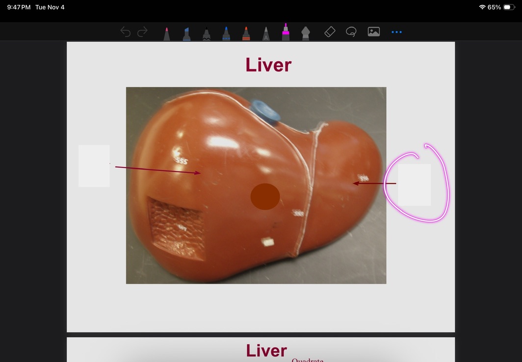 <p>What is this?</p>