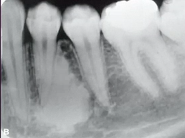 <p>how would you describe the internal structure of this lesion </p>