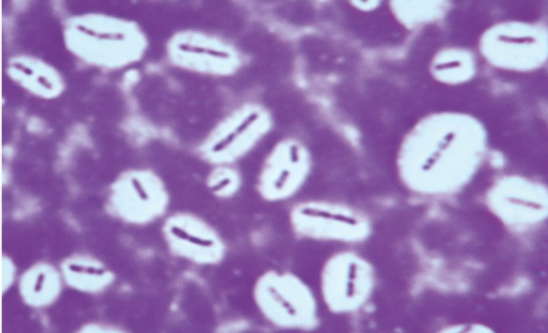 <p>What type of stain is this?</p><ol><li><p>Capsule stain</p></li><li><p>Acid fast stain</p></li><li><p>Endospore stain</p></li><li><p>Dark field microscopy</p></li></ol><p></p>