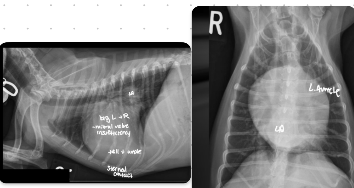 <p>-combo roentgen signs involving L and R cardiac chambers</p><p>-dogs often get mitral dz which results in both L+R heart enlargement</p><p>-tall + wide, sternal contact</p>