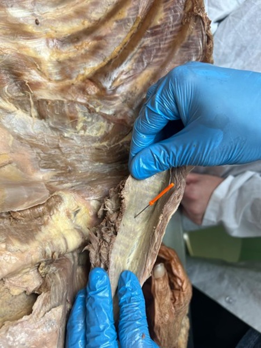<p>internal abdominal oblique muscle</p>