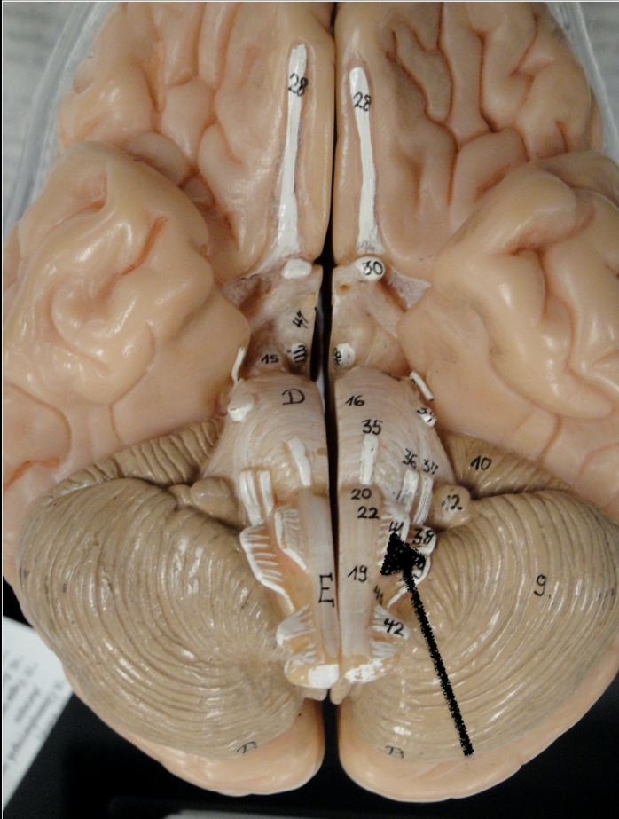 <p>name this cranial nerve</p>