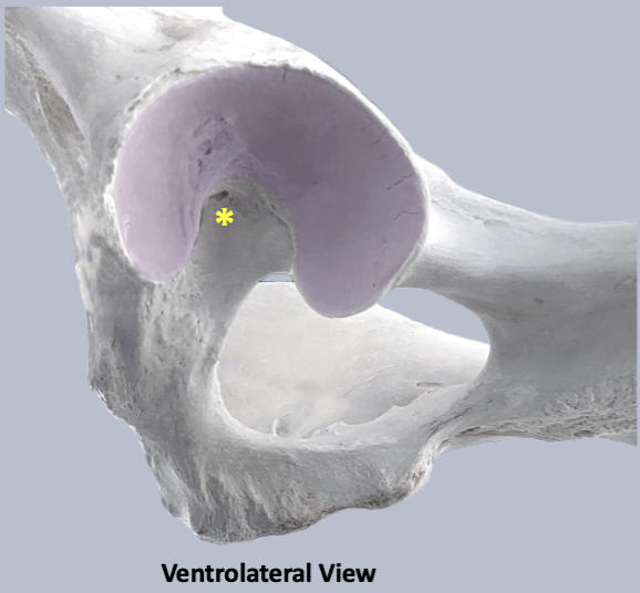 <p>acetabular fossa</p>