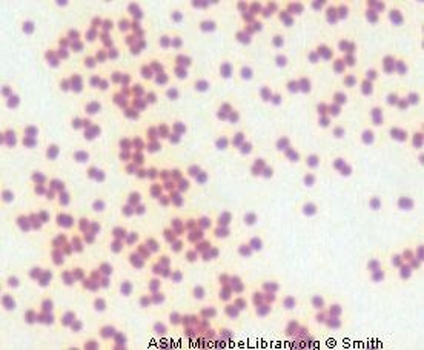 <p>Neisseria spp</p>