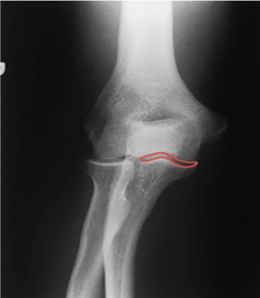 <p>What structure is highlighted?</p>