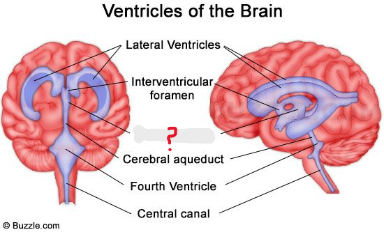 <p>What is this </p>