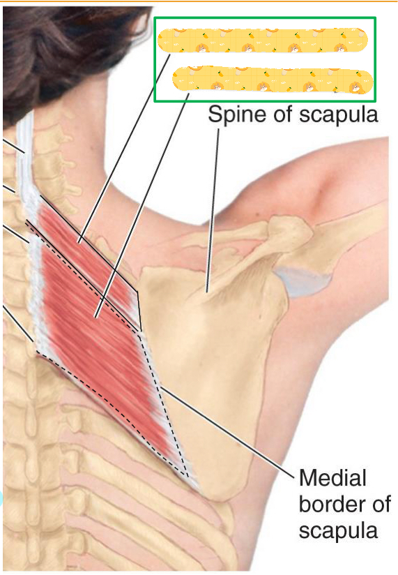<p>Name this muscle</p>