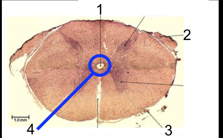 <p>what structure is #4? </p>