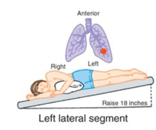 <p>What CPT position is pictured, and when is it used?</p>