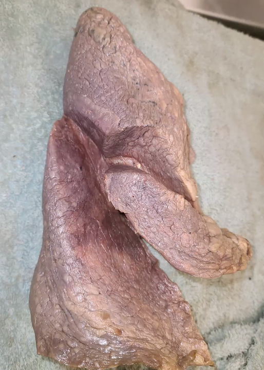 <p>which lung is this? </p>