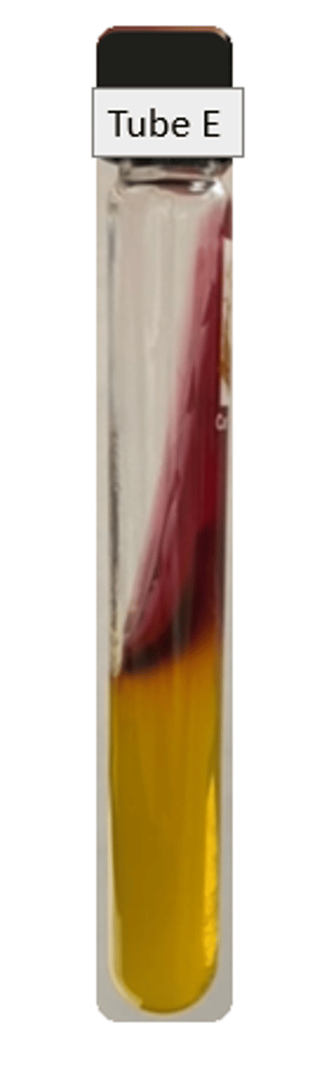 <p>Slant: alkaline</p><p>Butt: acidic</p><p>Gas: neg</p><p>H2S: pos</p>