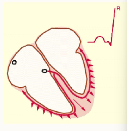 <ul><li><p>electrical impulse spreads across ventricular muscle</p></li><li><p>ventricles depolarise and contract (ventricular systole)</p></li><li><p>blood is ejected from the ventricles</p></li></ul><p></p>
