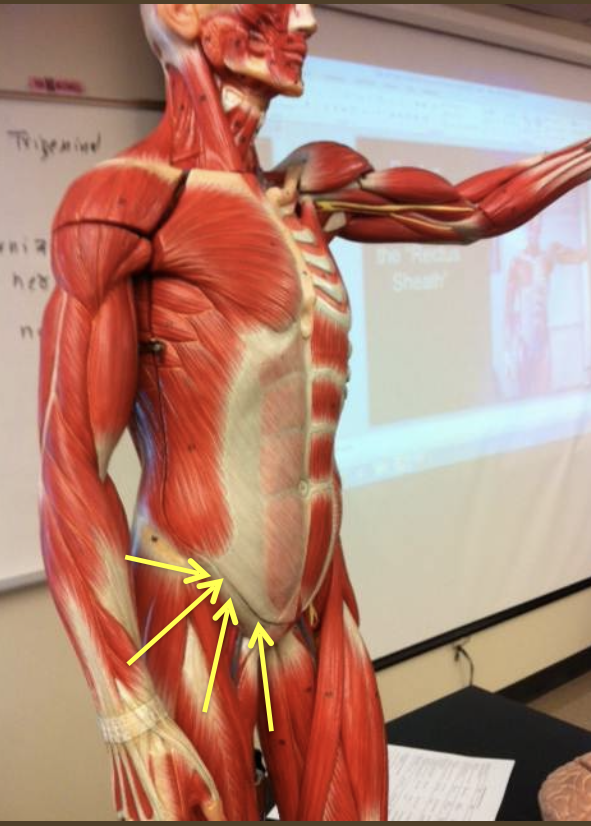 <p>Which ligament is this?</p>