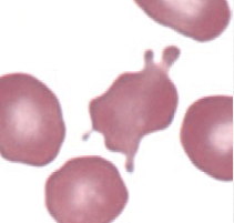 <ul><li><p>hemangiosarcoma</p></li><li><p>irregular spike-like projections</p><ul><li><p>unevenly distributed</p></li><li><p>variable length &amp; diameter</p></li></ul></li></ul><p></p>