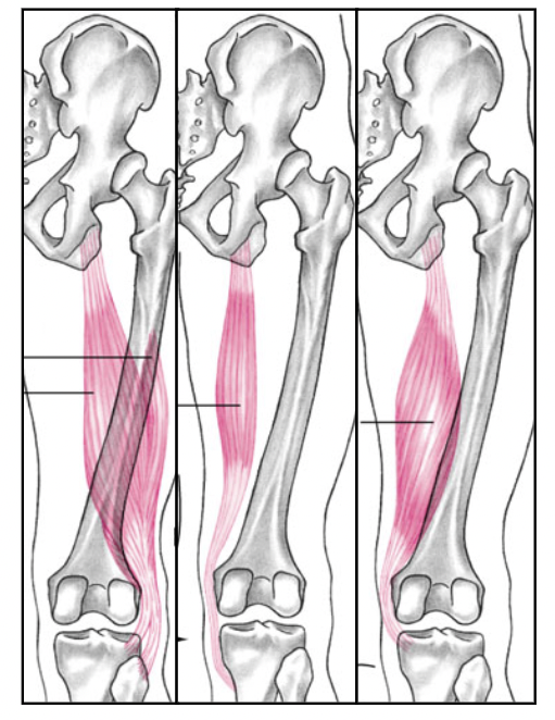 <p>knee flexion</p><p>agonists:</p><ol><li><p></p></li></ol>