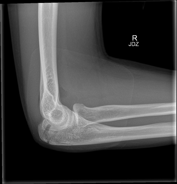<p>Describe the abnormality demonstrated. </p>