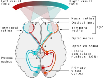 <ul><li><p>each eye sees both a left and right visual field which is processed by the contralateral hemisphere of the brain </p></li><li><p>light from left visual field hits nasal retina of left eye and temporal retina of the right eye/light from right visual field hits nasal retina of the right eye and temporal retina of the left eye </p></li><li><p>at the optic chiam (formed by optic nerve), fibres from the nasal retina cross to the opposite side but temporal fibres stay the same = partial decussation = info from left visual field of both eyes go to right hemisphere</p></li><li><p>chiasm forms the optic tract which carries info from the same visual field (left or right) from both eyes </p></li><li><p>this goes to the lateral geniculate nucleus (LGN) which fans out into optic radiations to the primary visual cortex (V1) - fibres from upper retina travel via parietal lobe (cuneus), fibres from lower retina travel via temporal lobe (meyers loop)</p></li></ul><p></p>