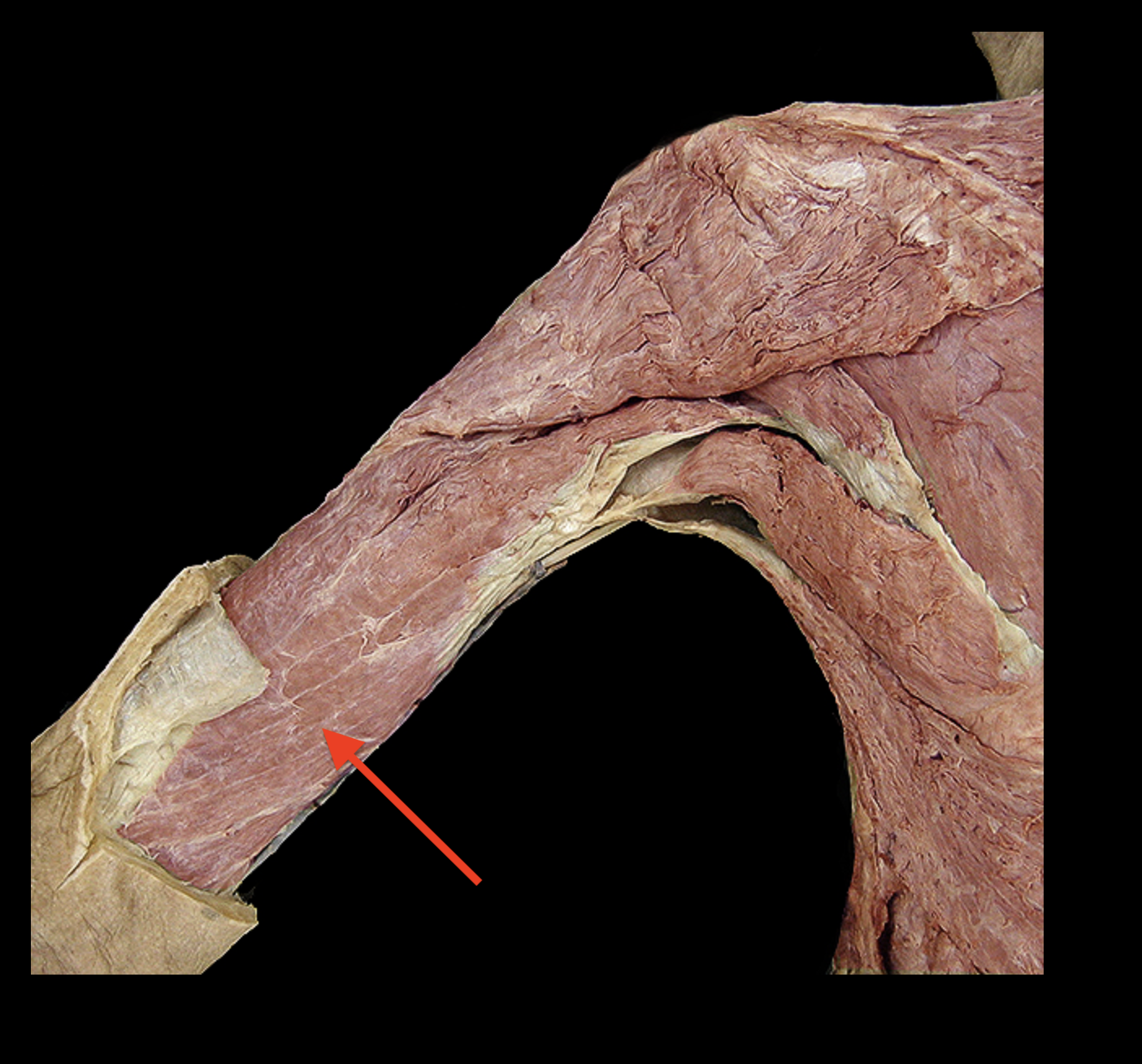 <p>What structure is the arrow pointing to</p>