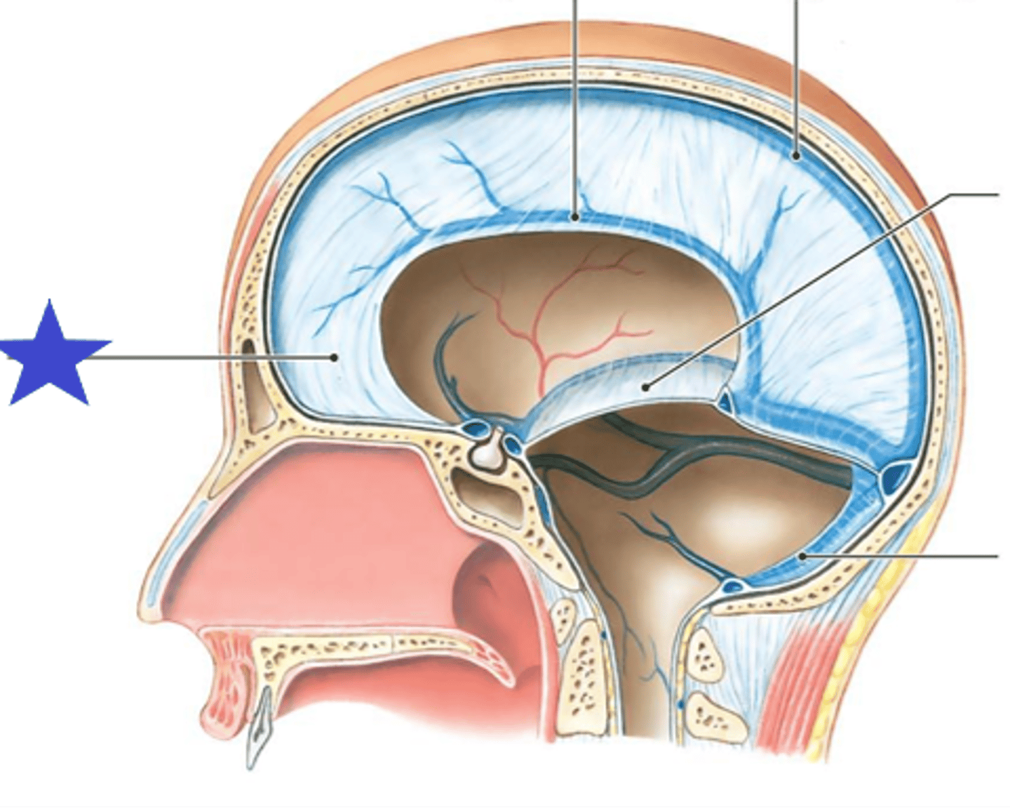 <p>The______________________ is the largest of the folds of dura mater. It attaches anteriorly to the crista galli. In its upper edge, it divides to form the superior sagittal sinus, and its lower edge is where it divides to form the inferior sagittal sinus.</p><p>A. Tentorium Cerebelli</p><p>B. Falx Cerebri</p><p>C. FalxCerebelli</p><p>D. Transverse Sinus</p><p>3 multiple choice options</p>