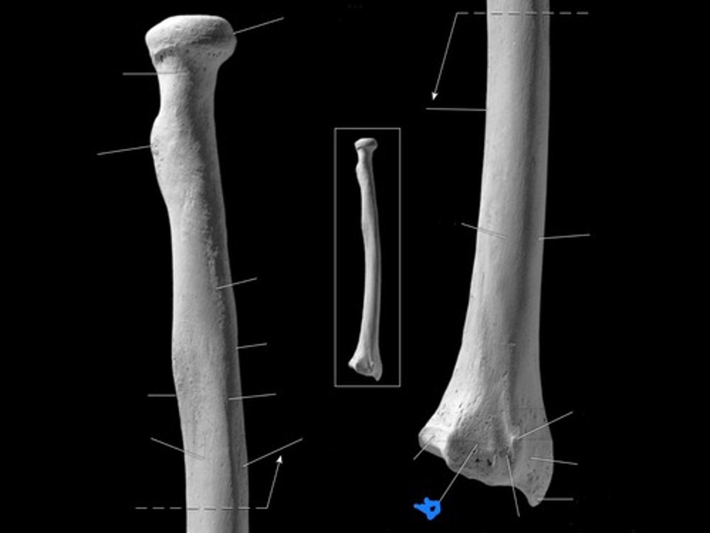 <p>posterior </p>