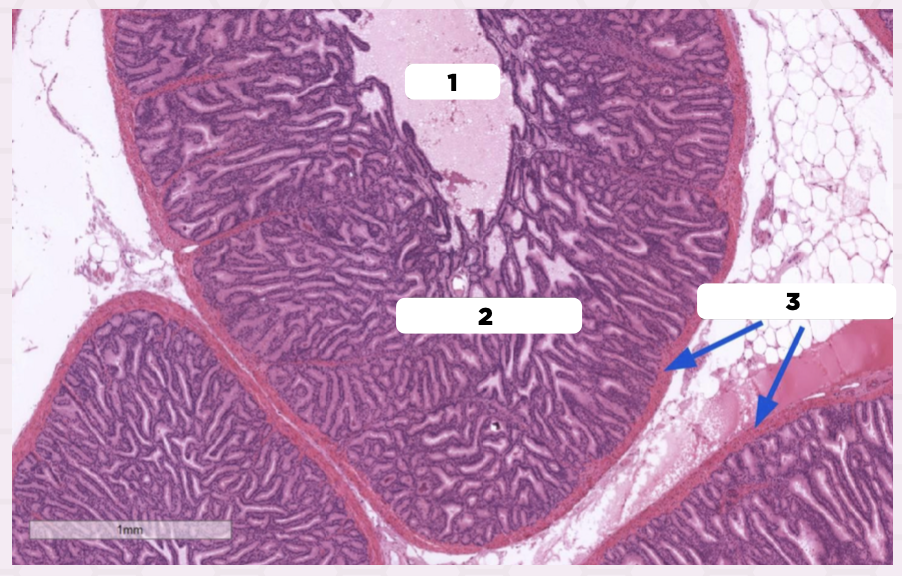 <p>The epithelial lining of the structure labelled #2 is _____.</p><p>A. Simple Squamous Epithelium</p><p>B. Stratified Squamous Epithelium</p><p>C. Simple Columnar Epithelium</p><p>D. Pseudostratified Columnar Epithelium</p>