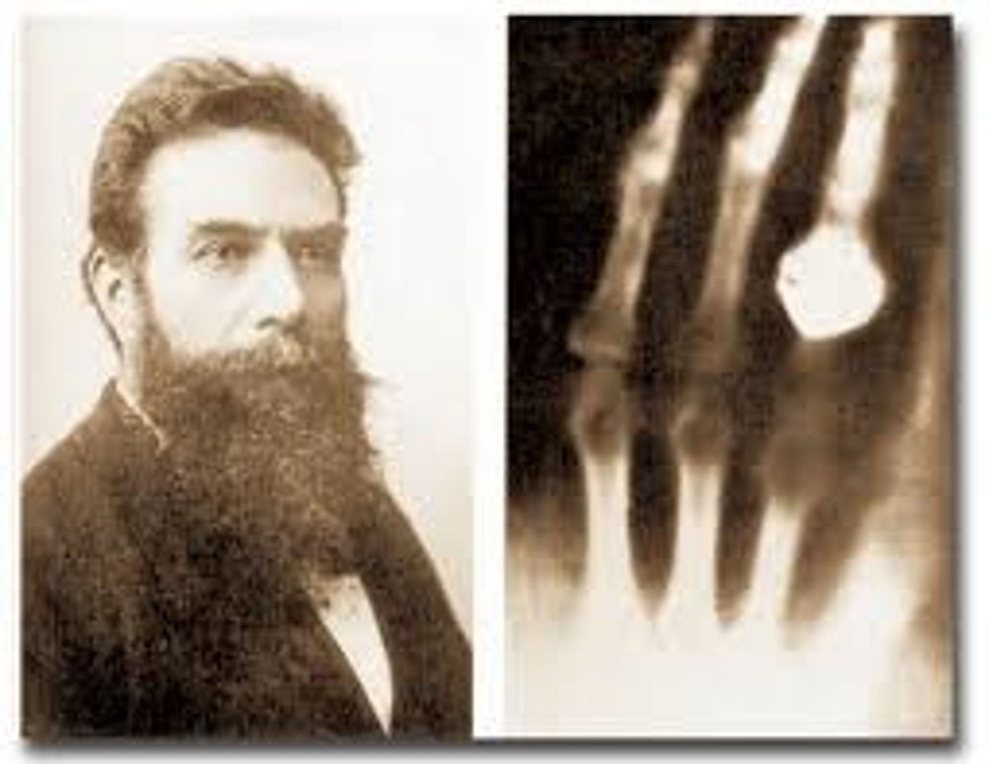 <p>Wilhelm Roentgen</p>