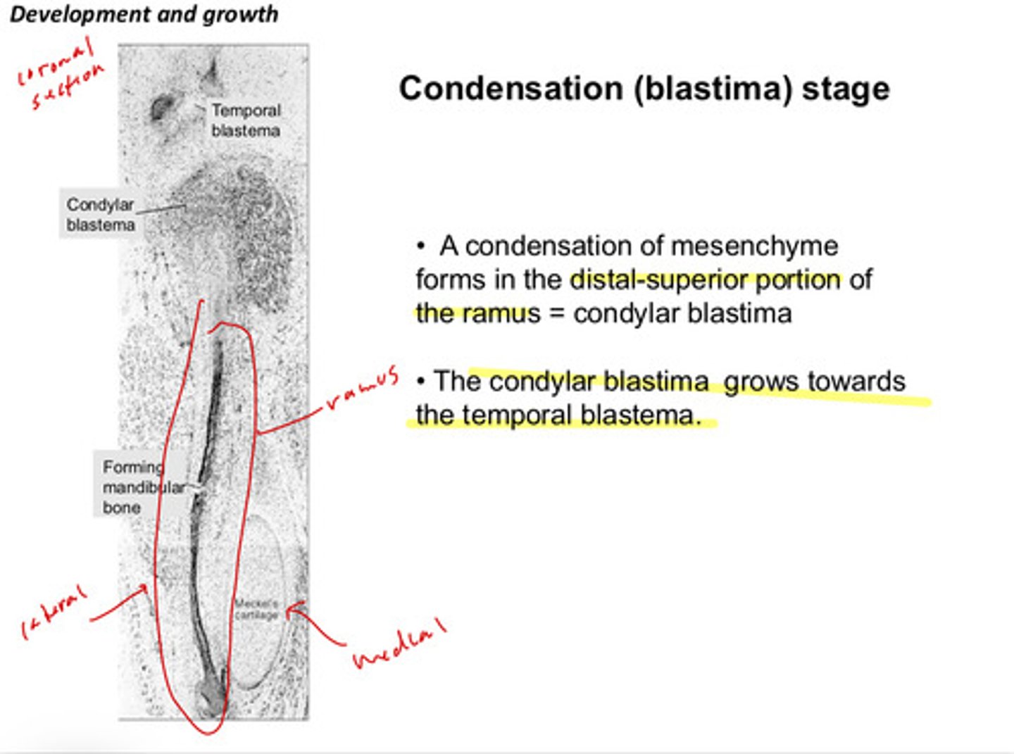 <p>condylar blastima</p>