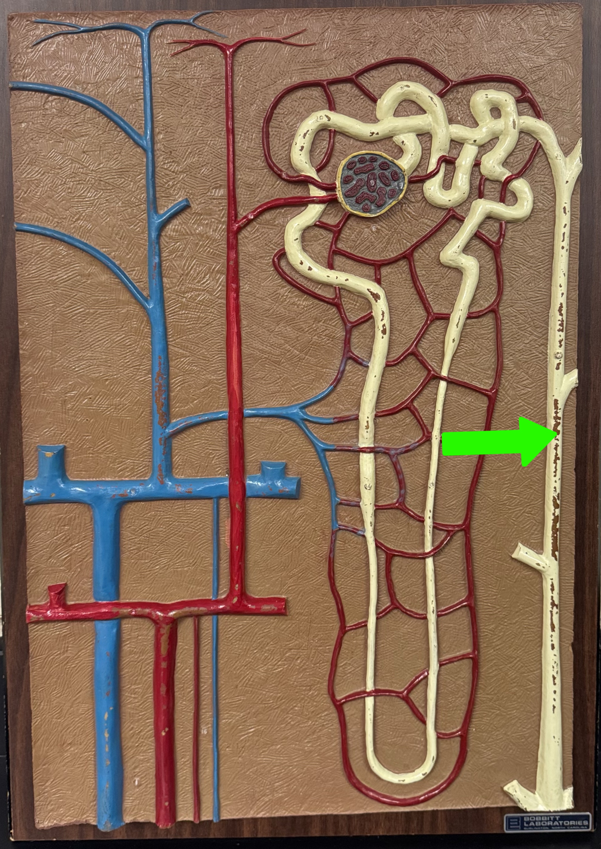 <p>What are these parts of the nephron?</p>